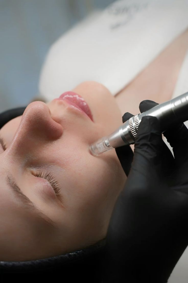 Formation Microneedling